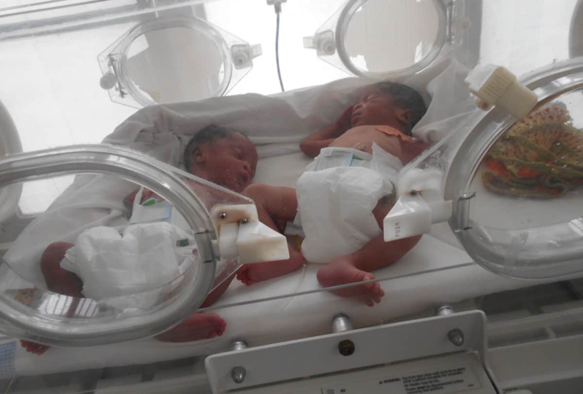 Les jumeaux juste après leur naissance, pris en charge dans une unité de néonatologie